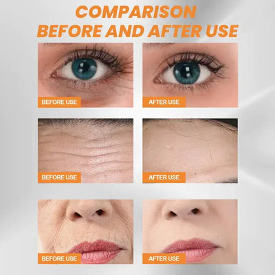EELHOE Collagen Eye Mask for Puffiness